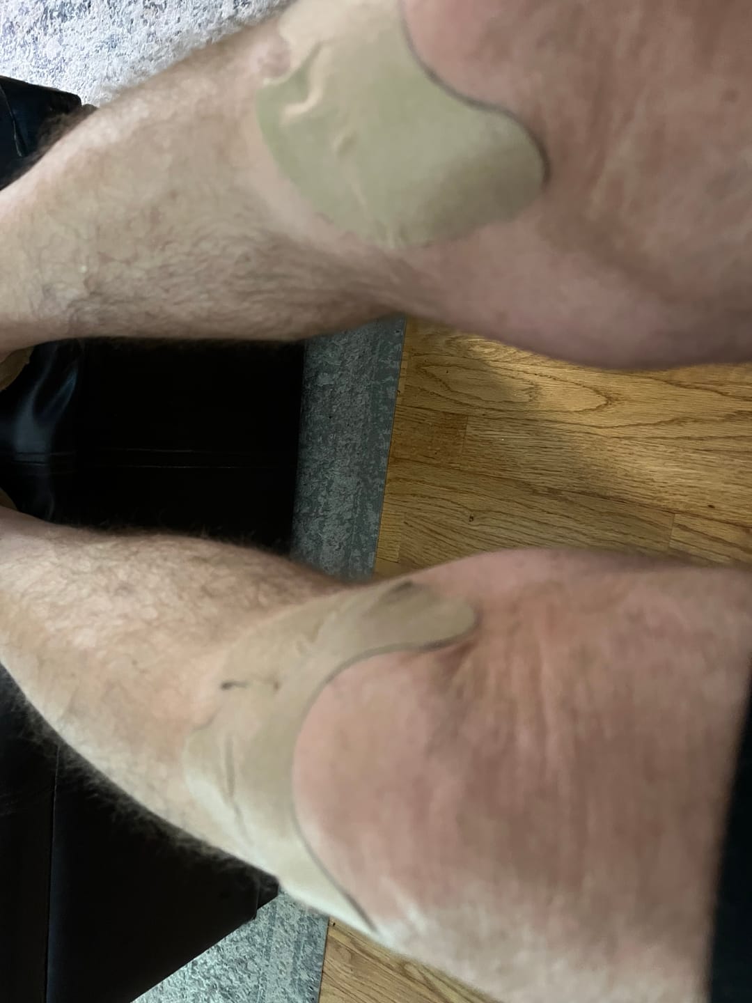 Customer photo review of Auxillium Knee Patch (fka Heaven Patch)