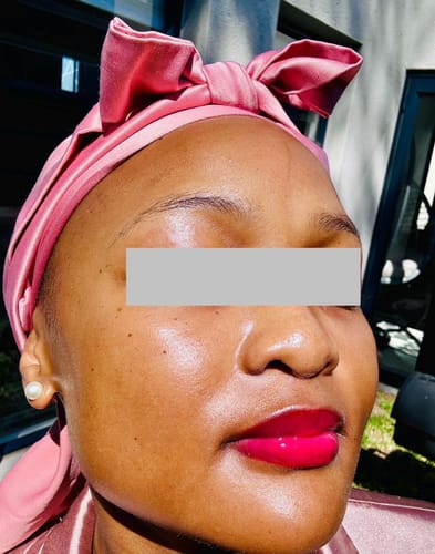 Customer photo review of OceaGlow Marine Collagen