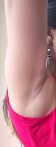 Customer photo review of Pink Blossom - Intimate Area Brightening Treatment