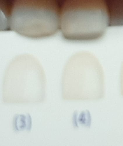 Customer photo review of Cocomint Pulling Oil with 7 Essential Oils & Vitamins D3, E & K2 (Mickey D Formula) - 8 oz