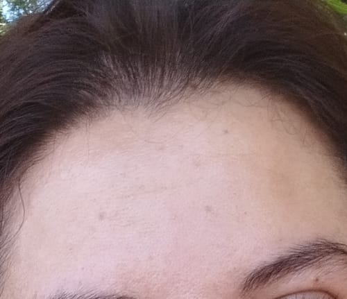Customer photo review of Kit Anticaída  Shampoo en barra y Tónico