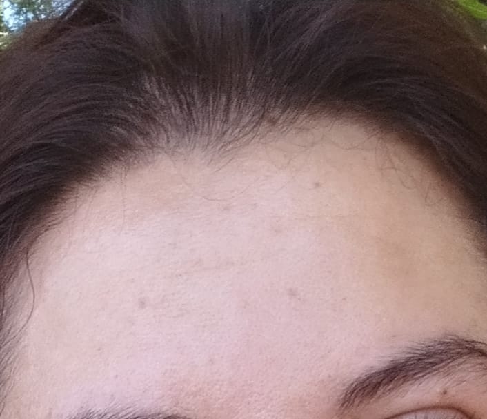 Customer photo review of Kit Anticaída  Shampoo en barra y Tónico