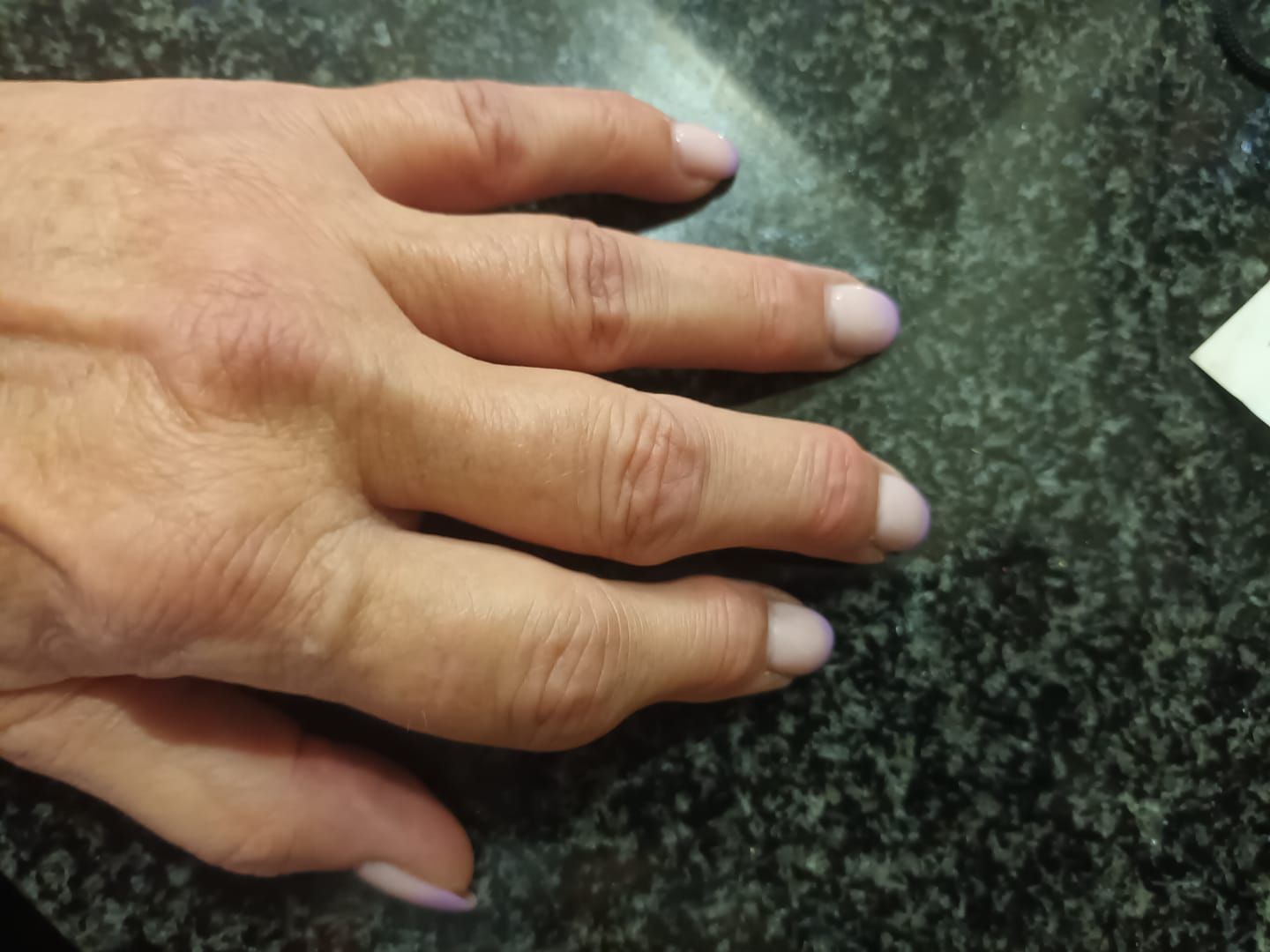 Customer photo review of Outback Joint Support