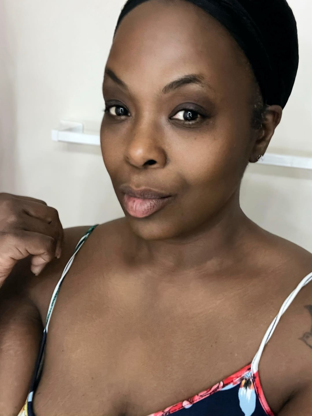 Customer photo review of Magic Eraser Dark Spot Cream
