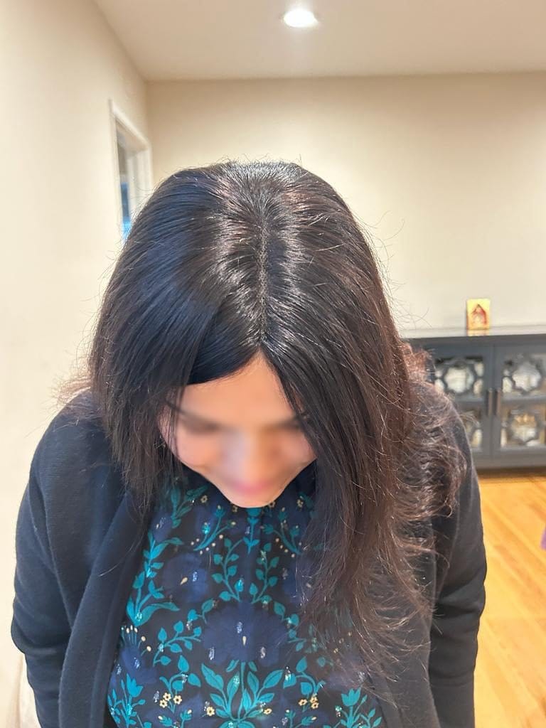 Customer photo review of Best Hair Toppers For Women Virgin Real Human Hair Topper #1B