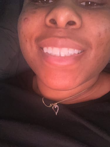 Customer photo review of Cocomint Pulling Oil with 7 Essential Oils & Vitamins D, E & K2 (Mickey D Formula)  - 16 oz