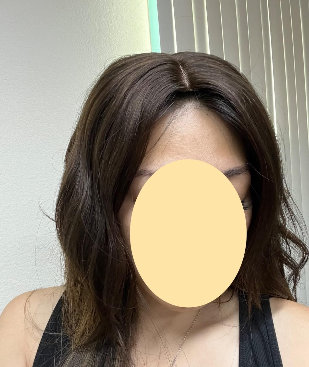 Customer photo review of Dark Brown Virgin Hair Medium Base Mono Topper Human Hair #2