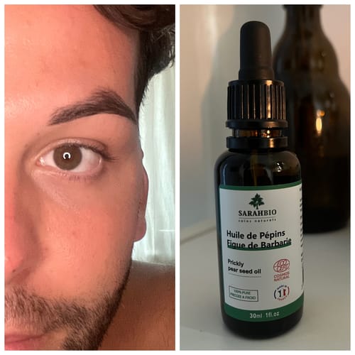 Customer photo review of Huile de Pépins de Figue de Barbarie - 30 ml