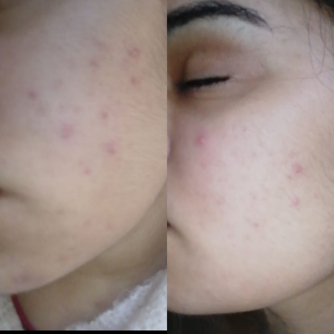 Customer photo review of Spectra Matt SC SPF 40