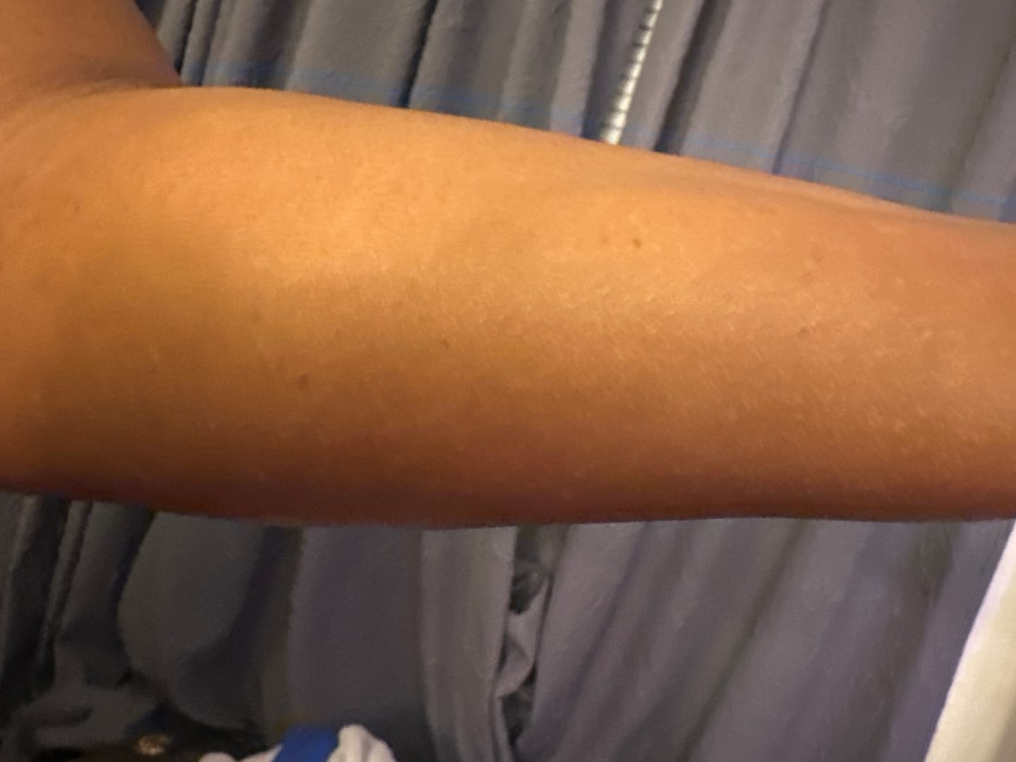 Customer photo review of Fair and White Exclusive Whitenizer Serum with Pure Vitamin "C" 30 ml / 1 fl oz
