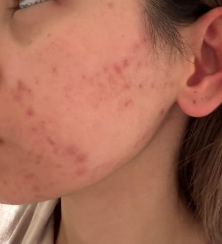 Customer photo review of 20-Day Inside & Out™ Gut Program