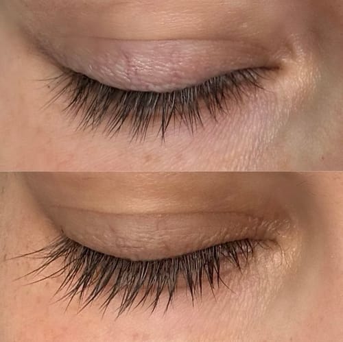 Customer photo review of iGlow Lash Maximizer - Lash Serum, 3 ml