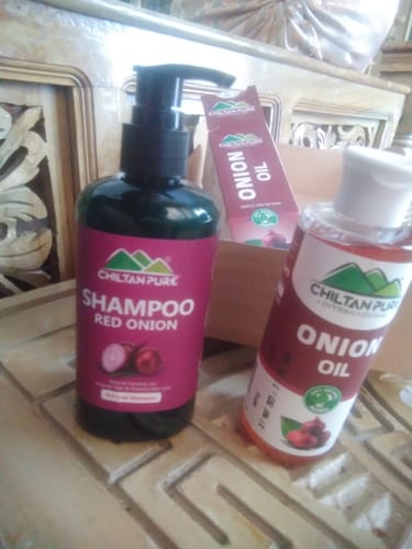 Customer photo review of Red Onion Shampoo 🧅 Natural Solution for Regrow Hair & Prevent Hair Loss 100% Results