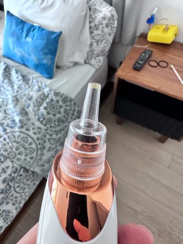 Customer photo review of SkinGlow™ Multifunctional Pore Vacuum