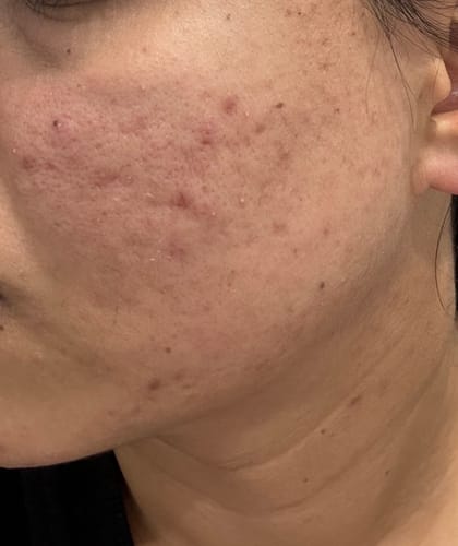 Customer photo review of 20-Day Inside & Out™ Gut Program