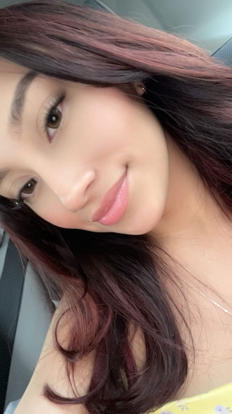 Customer photo review of 2Dadoll Calico Brown Contact Lenses(1 pair/6 months)