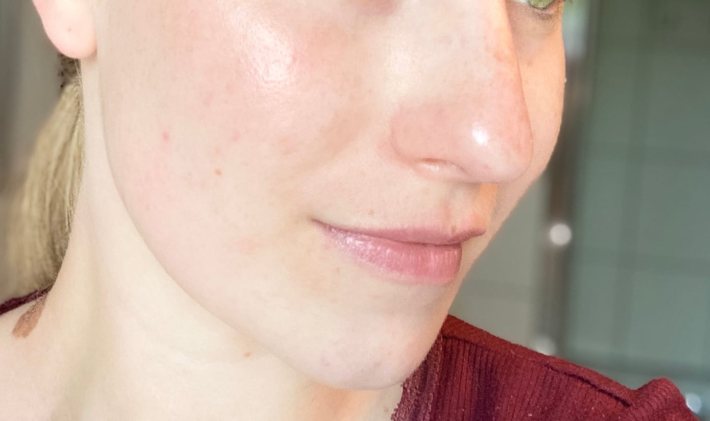 Customer photo review of Madecassoside Cream 2X