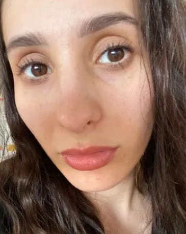 Customer photo review of Toplash eyelash and eyebrow growth serum — 3ml