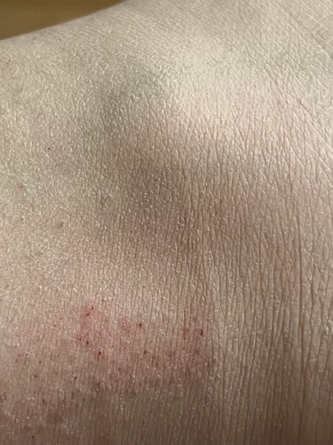 Customer photo review of Depilo - Haarentferner