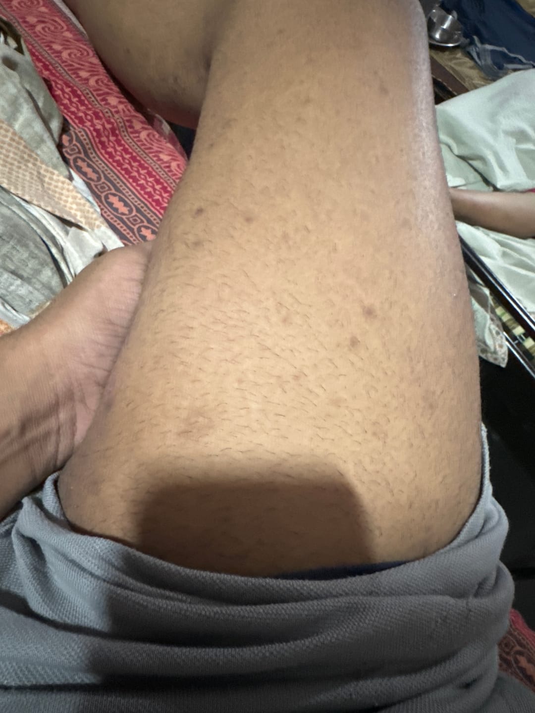 Customer photo review of FCL Bio Retinol Body Lotion | 200 ML