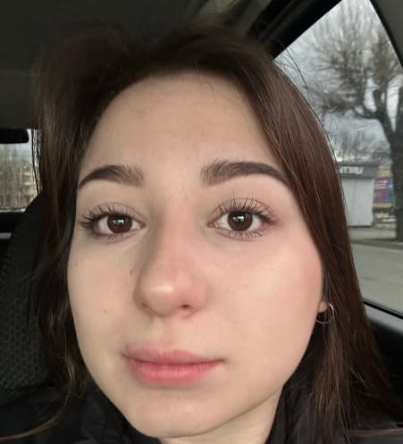 Customer photo review of Toplash eyelash and eyebrow growth serum — 3ml