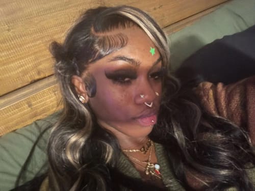 Customer photo review of Balayage Highlight Brown With Honey Blonde Skunk Stripe Glueless Wig Pre Cut 5x5 Lace Pre Bleached Knots