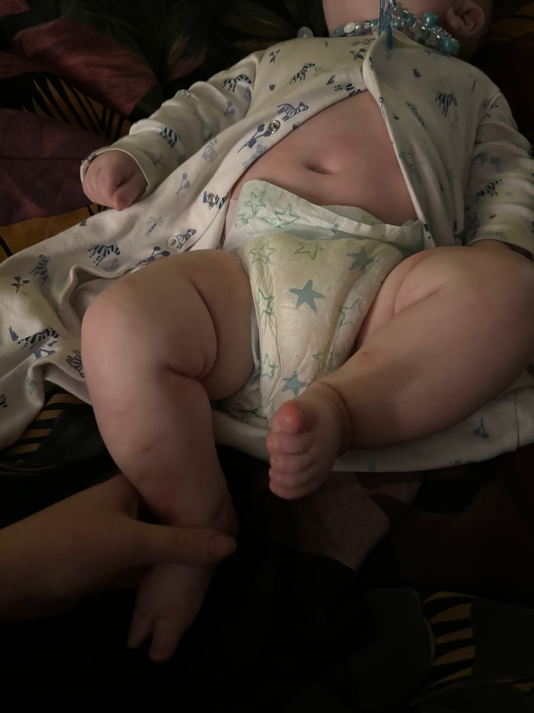 Customer photo review of Bioskin Junior Duo Pack (Free Outbreak Rescue Cream)