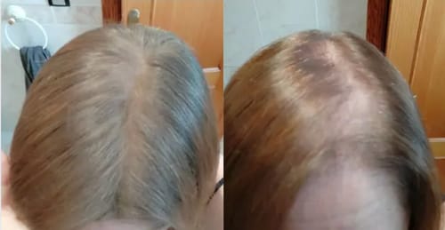 Customer photo review of Valenzia™ - HairFlair Haarfiller