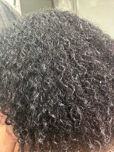 Customer photo review of Hair Recovery Bundle