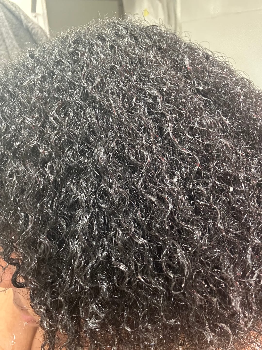 Customer photo review of Hair Recovery Bundle