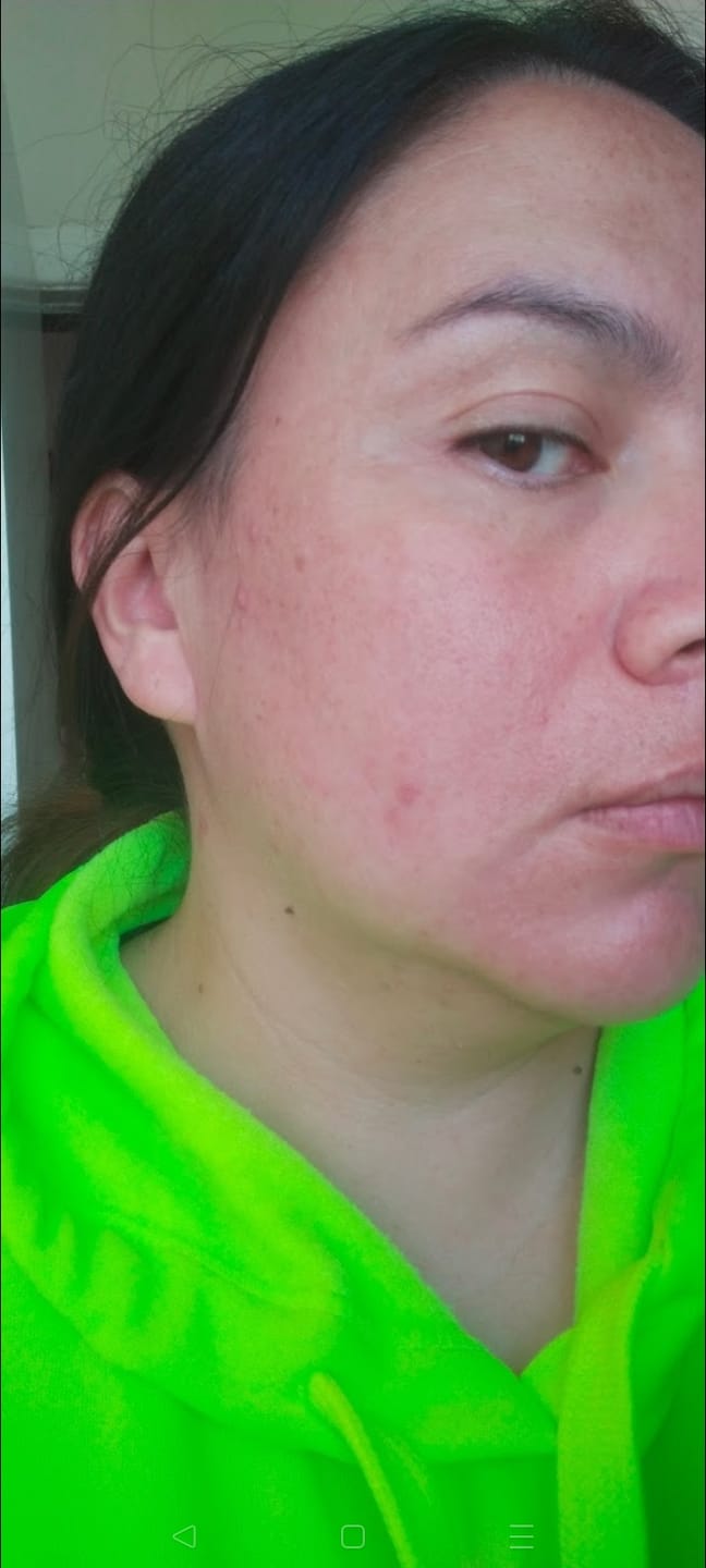Customer photo review of LOVESKIN Mini Ritual