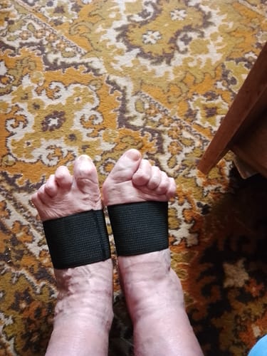 Customer photo review of Réz Nanoszálas Kompressziós Harántemelő Támasz