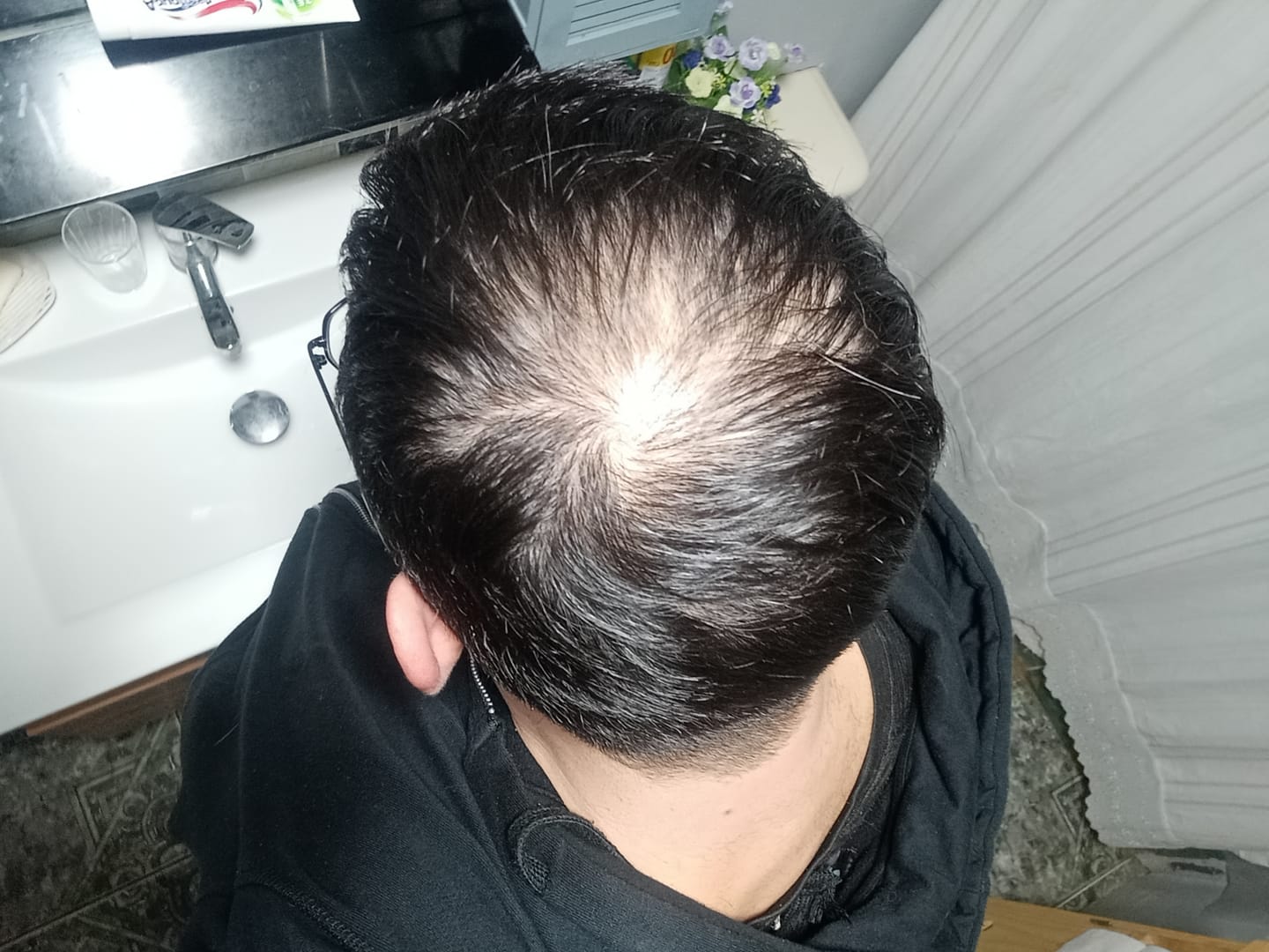 Customer photo review of Tratamiento anticaída 1 mes + Biotina