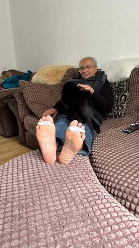 Customer photo review of HF Hammer Toe Gel Pad – For Everyday Comfort & Protection