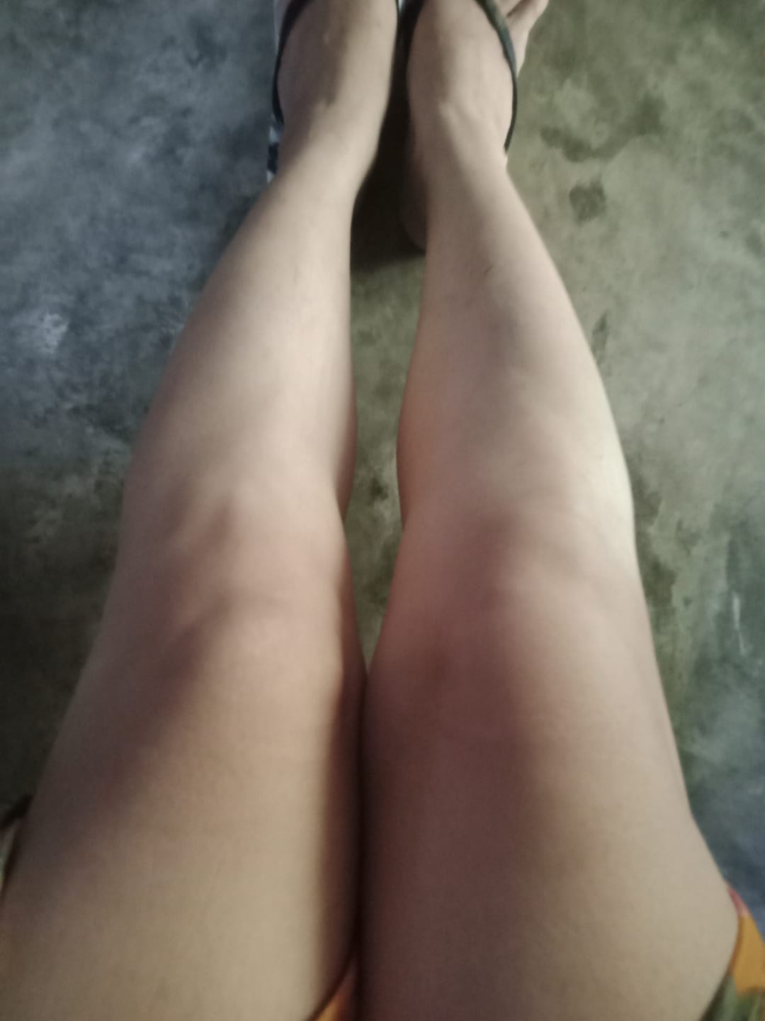 Customer photo review of Rosmar gluta peeling soap