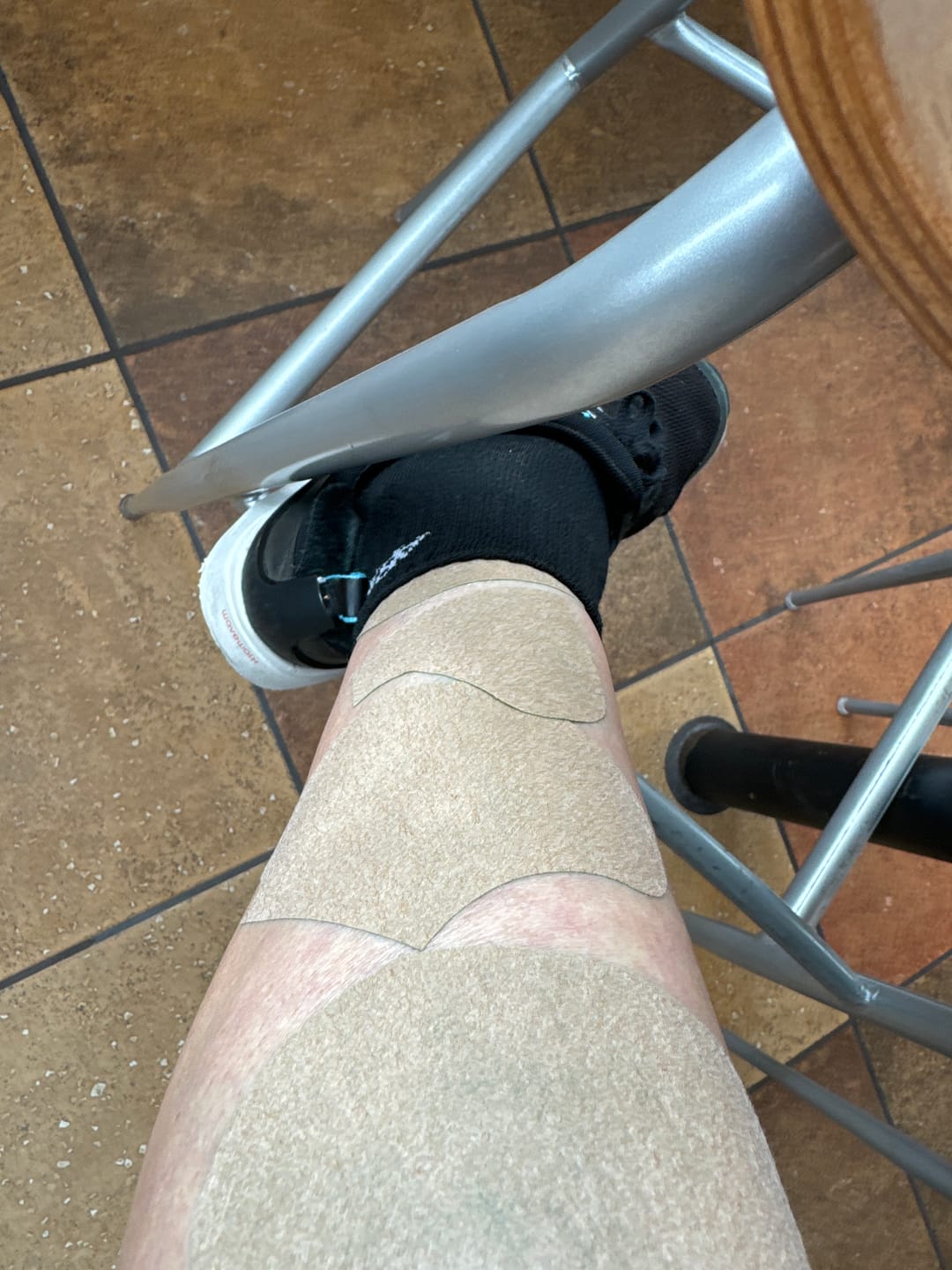 Customer photo review of Auxillium Knee Patch (fka Heaven Patch)