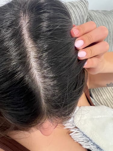 Customer photo review of ערכה כפולה לשיער: 2 שמפו טיפולי לקשקשים ו-2 מרכך | Scalp Control