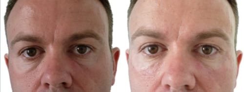 Customer photo review of Skin Guard Stem Cell Moisturizer (CC)