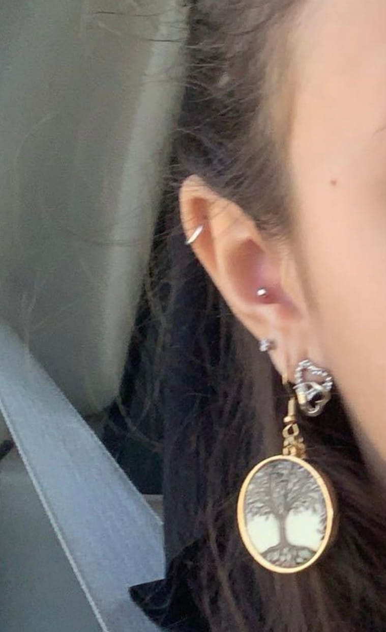 Customer photo review of Labret Insertion Tool