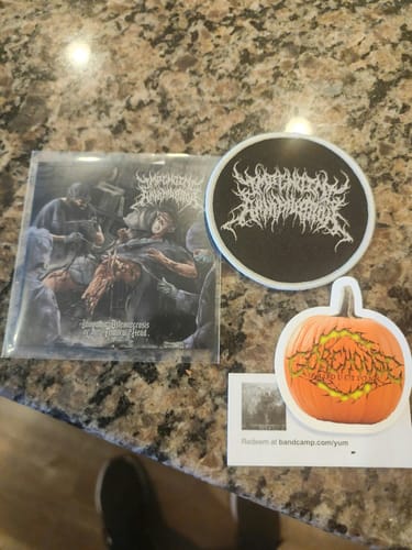 Customer photo review of Impending Annihilation - Idiopathic Osteonecrosis of the Femoral Head