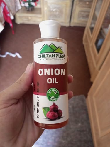 Customer photo review of Red Onion Oil 🧅 Reduces Hair Fall &amp; Accelerates Hair Regrowth [پیاز کا تیل].. Trending.... 🔥