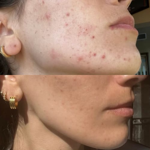 Customer photo review of Tisane Glow up ®