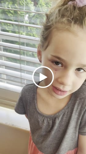 Customer video review of Heart Duo (PREORDER)