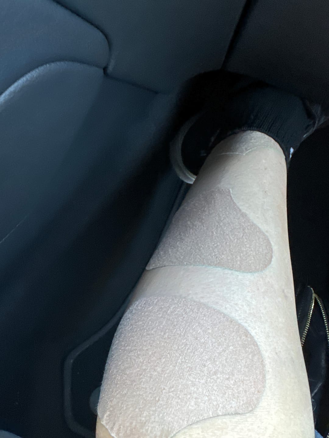 Customer photo review of Auxillium Knee Patch (fka Heaven Patch)