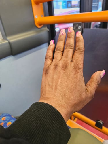 Customer photo review of Dark spots + Glow combo