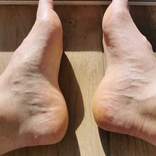 Customer photo review of LOVASKIN INSTANT FOOT PEEL XL - one 75 ml spray bottle and a 250 ml refill bottle - 110 Beauty treatments