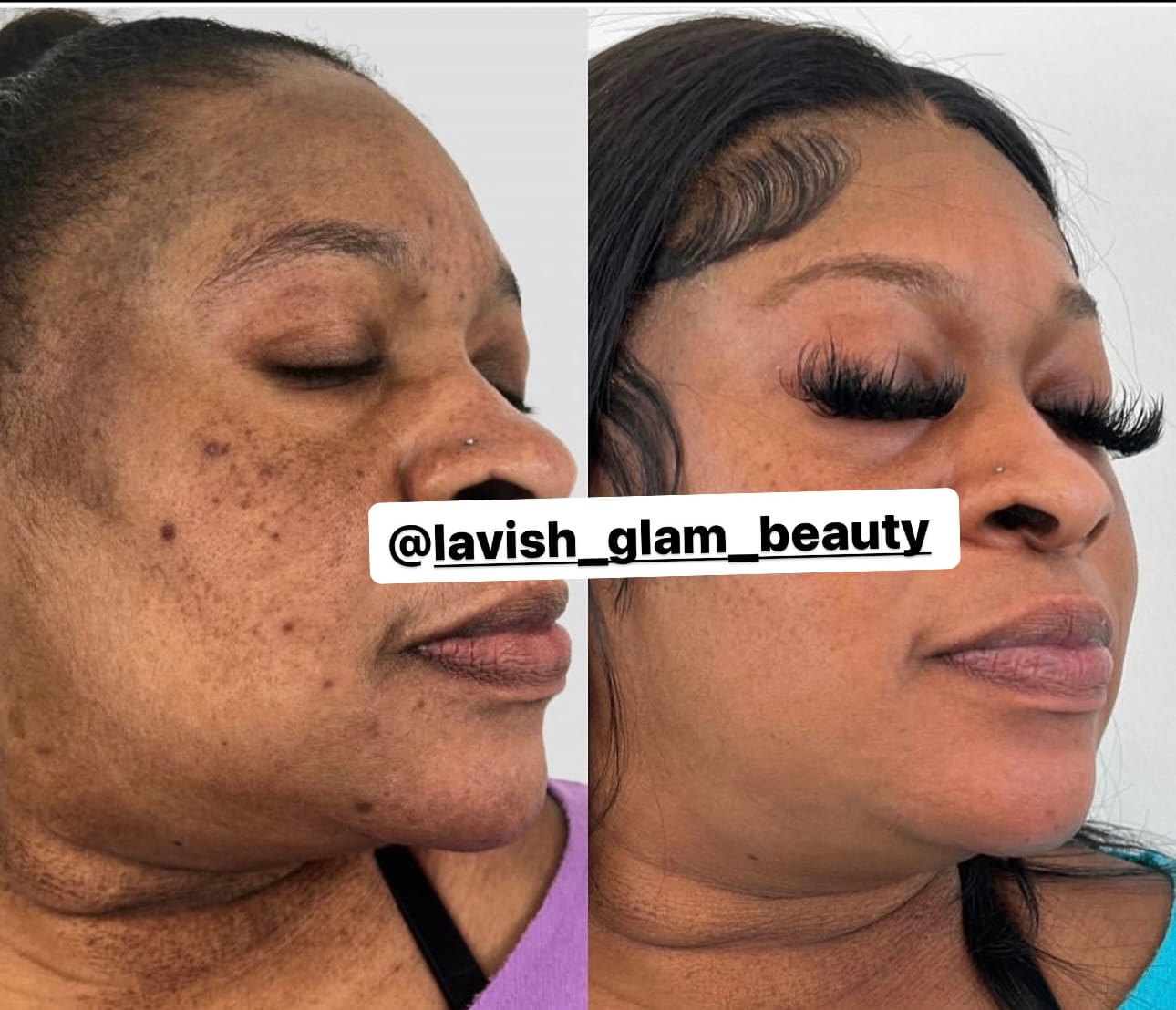 Customer photo review of Glass Skin Brighten Up Pads (Turmeric & kojic acid)