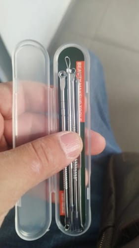 Customer photo review of Acne Removal Tool