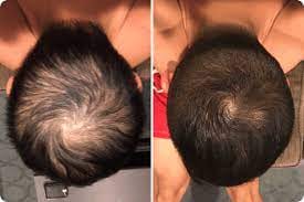 Customer photo review of Root Activator Styling Wax (CC)