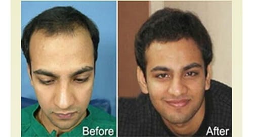 Customer photo review of Root Activator Styling Wax (CC)